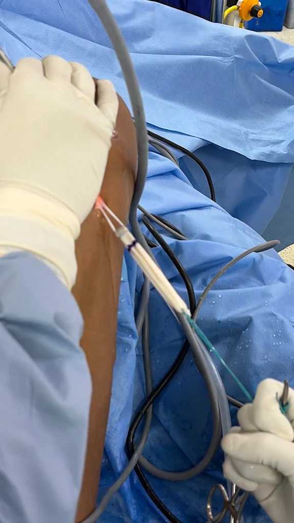 Dr. Nikhil Gupta clinical gallery photograph 16