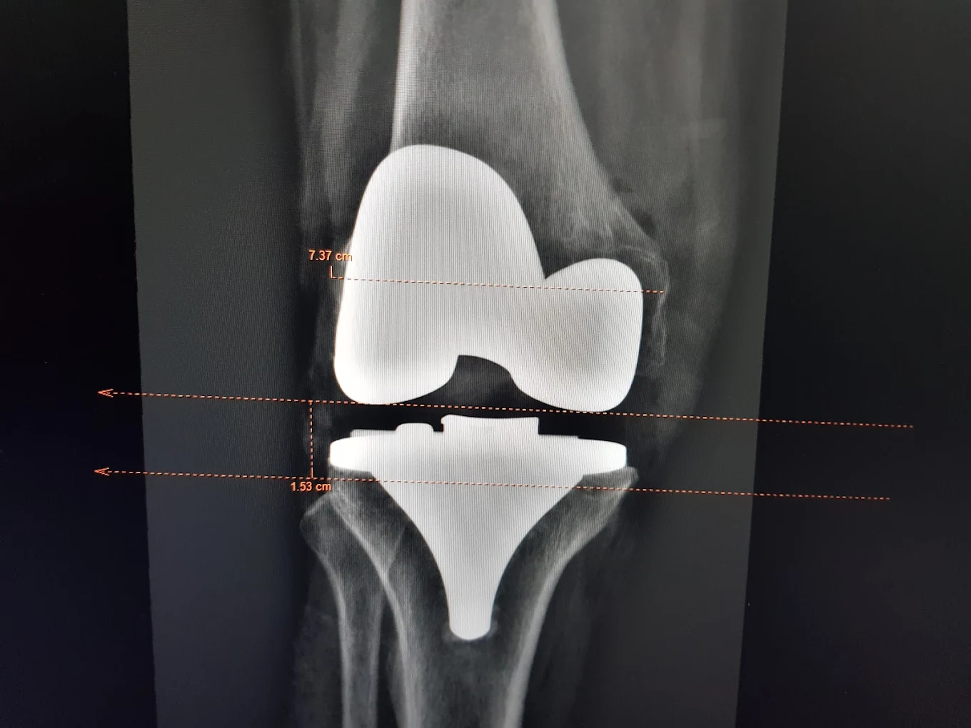 Dr. Nikhil Gupta clinical gallery photograph 17