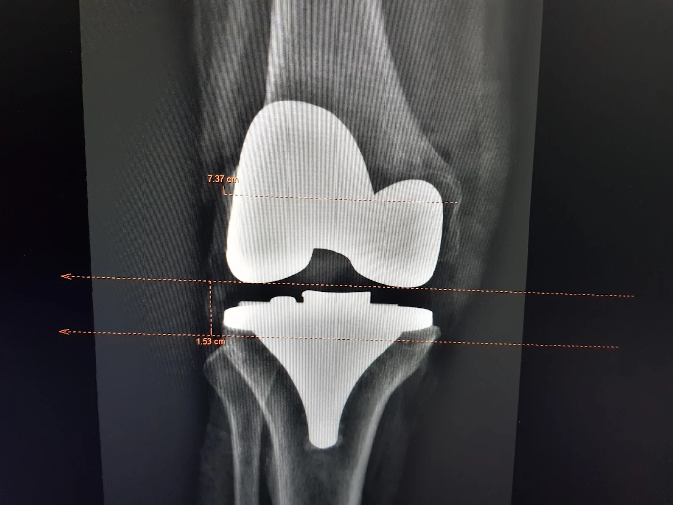 Dr. Nikhil Gupta clinical gallery photograph 18