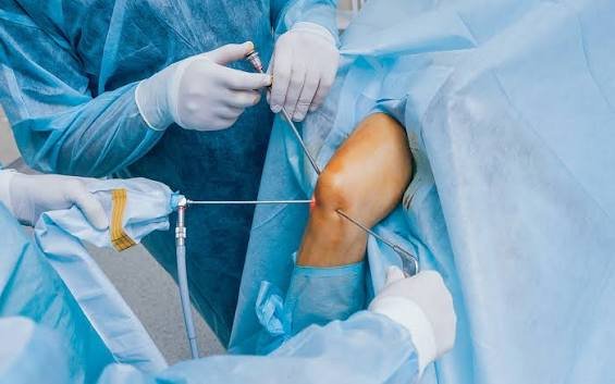 Knee arthroscopy procedure for ligament and meniscus treatment